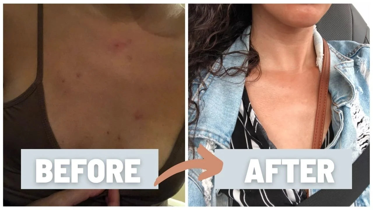 Close-up of Kismet Unblurred Calming Serum's texture on skin